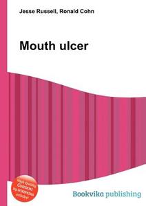 Mouth Ulcer di Jesse Russell, Ronald Cohn edito da Book On Demand Ltd.