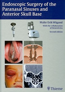 Endoscopic Surgery Of The Paranasal Sinuses And Anterior Skull Base di M. E. Wigand edito da Thieme Publishing Group