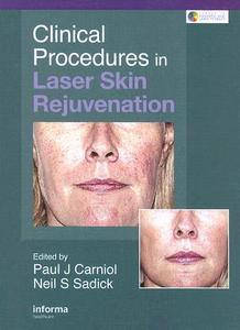 Clinical Procedures in Laser Skin Rejuvenation di Paul Carniol edito da CRC Press
