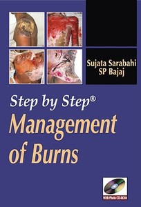 Step by Step Management of Burns di Sujata Sarabahi, S. P. Bajaj edito da MCGRAW HILL MEDICAL