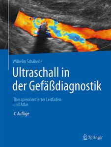 Ultraschall in der Gefäßdiagnostik di Wilhelm Schäberle edito da Springer-Verlag GmbH