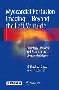 Myocardial Perfusion Imaging di Vincent L. Sorrell, M. Elizabeth Oates edito da Springer International Publishing Ag
