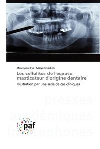 Les cellulites de l'espace masticateur d'origine dentaire di Moussaoui Eya, Maryem Kerkeni edito da Presses Académiques Francophones