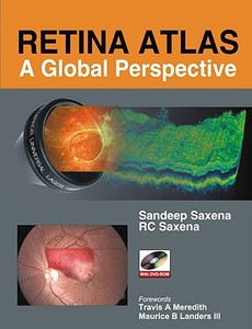 Saxena, S: Retina Atlas: A Global Perspective di Sandeep Saxena edito da McGraw-Hill Education
