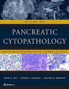 Atlas of Pancreatic Cytopathology: With Histopathologic Correlations di Syed Z. Ali, Yener S. Erozan, Ralph H. Hruban edito da DEMOS HEALTH
