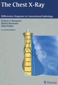 The Chest X-Ray: Differential Diagnosis in Conventional Radiology di Francis A. Burgener, Martti Kormano, Tomi Pudas edito da THIEME MEDICAL PUBL INC