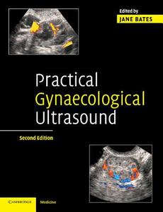 Practical Gynaecological Ultrasound edito da Cambridge University Press