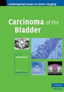 Carcinoma of the Bladder di David Macvicar edito da Cambridge University Press