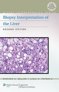 Biopsy Interpretation Of The Liver di Stephen A. Geller, Lydia M. Petrovic edito da Lippincott Williams And Wilkins