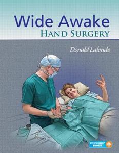 Wide Awake Hand Surgery edito da Thieme Medical Publishers Inc