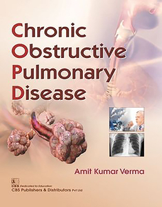 Chronic Obstructive Pulmonary Disease di Amit K. Verma edito da CBS PUB & DIST PVT LTD INDIA