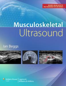 Musculoskeletal Ultrasound di Ian Beggs edito da LWW