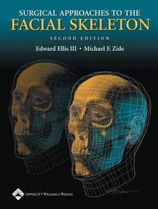 Surgical Approaches To The Facial Skeleton di Edward Ellis, Michael F. Zide edito da Lippincott Williams And Wilkins