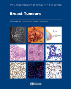 Breast Tumours edito da WORLD HEALTH ORGN