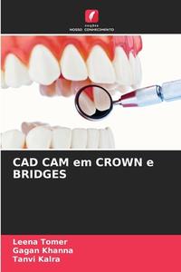CAD CAM em CROWN e BRIDGES di Leena Tomer, Gagan Khanna, Tanvi Kalra edito da Edições Nosso Conhecimento