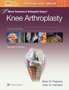 Master Techniques in Orthopedic Surgery: Knee Arthroplasty (Master Techniques in Orthopaedic Surgery) di Mark W. Pagnano, Arlen D. Hanssen edito da Lippincott Williams&Wilki