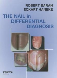 Nail In Differential Diagnosis di Robert Baran, Eckart Haneke edito da Taylor & Francis Ltd