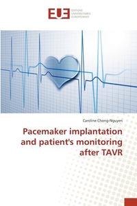Pacemaker implantation and patient's monitoring after TAVR di Caroline Chong-Nguyen edito da Editions universitaires europeennes EUE
