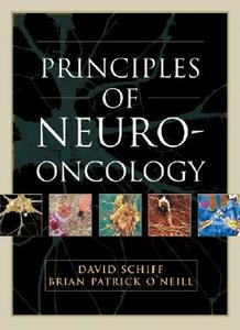 Cancer Of The Nervous System di David Schiff edito da Mcgraw-hill Education - Europe