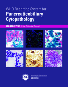 Who Reporting System for Pancreaticobiliary Cytopathology edito da WORLD HEALTH ORGN