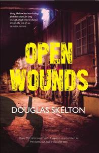 Open Wounds di Douglas Skelton edito da Luath Press Ltd
