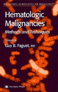 Hematologic Malignancies edito da Humana Press