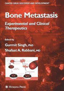 Bone Metastasis edito da Humana Press
