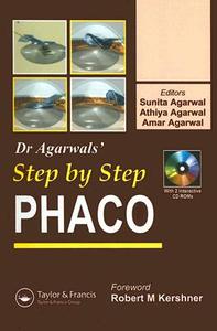 Step By Step Phacoemulsification di Sunita Agarwal, Athiya Agarwal, Amar Agarwal edito da Taylor & Francis Ltd