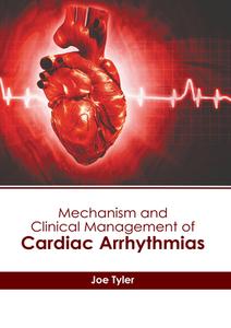 Mechanism and Clinical Management of Cardiac Arrhythmias edito da HAYLE MEDICAL