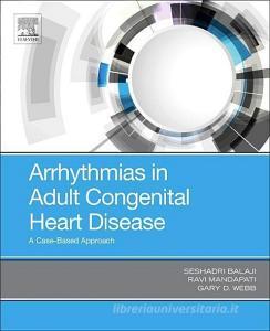 Arrhythmias in Adult Congenital Heart Disease di Webb, Ravi Mandapati, Seshadri Balaji edito da Elsevier - Health Sciences Division