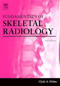 Fundamentals Of Skeletal Radiology di Clyde Helms edito da Elsevier Health Sciences