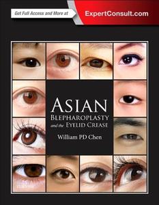 Asian Blepharoplasty And The Eyelid Crease di William P. Chen edito da Elsevier - Health Sciences Division