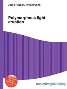 Polymorphous Light Eruption edito da Book On Demand Ltd.