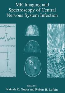 MR Imaging and Spectroscopy of Central Nervous System Infection edito da Springer US