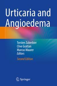 Urticaria and Angioedema edito da Springer International Publishing