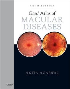 Gass' Atlas Of Macular Diseases di Anita Agarwal edito da Elsevier Health Sciences