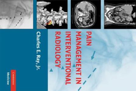 Pain Management in Interventional Radiology di Jr. Ray edito da Cambridge University Press