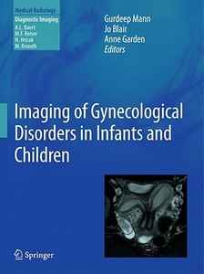 Imaging Of Gynecological Disorders In Infants And Children edito da Springer-verlag Berlin And Heidelberg Gmbh & Co. Kg