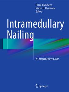 Intramedullary Nailing edito da Springer London Ltd