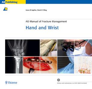 Ao Manual Of Fracture Management - Hand And Wrist di Jesse B. Jupiter, David C. Ring edito da Thieme Publishing Group