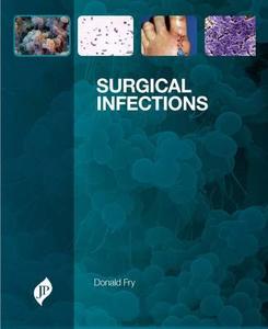 Surgical Infections di Donald Fry edito da Jaypee Brothers Medical Publishers Pvt Ltd