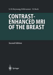 Contrast-Enhanced MRI of the Breast di Rainer Beck, Sylvia Heywang-Köbrunner edito da Springer Berlin Heidelberg