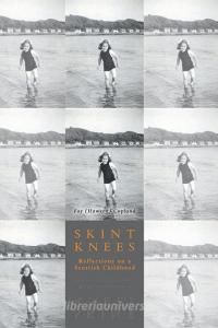 Skint Knees di Fay Copland edito da FriesenPress