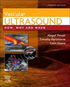 Vascular Ultrasound edito da Elsevier Health Sciences