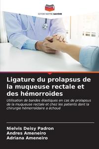 Ligature du prolapsus de la muqueuse rectale et des hémorroïdes di Nielvis Deisy Padron, Andres Ameneiro, Adriana Ameneiro edito da Editions Notre Savoir