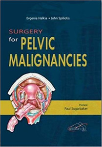 Surgery for Pelvic Malignancies di Evgenia Halkia MD, John Spiliotis MD edito da BROKEN HILL PR