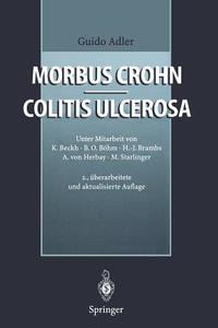 Morbus Crohn - Colitis ulcerosa di Guido Adler edito da Springer Berlin Heidelberg