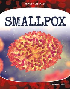 Smallpox di Tammy Gagne edito da CORE LIB
