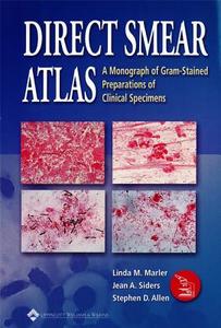 The Direct Smear Atlas di Linda M. Marler, Jean A. Siders, Stephen D. Allen edito da Lippincott Williams And Wilkins