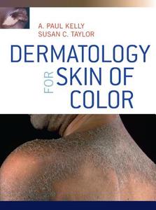 Dermatology For Skin Of Color di Susan C. Taylor, A. Paul Kelly edito da Mcgraw-hill Education - Europe